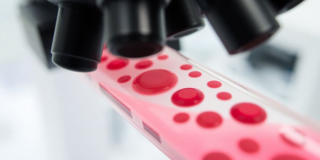 o que é segmentados no exame de sangue